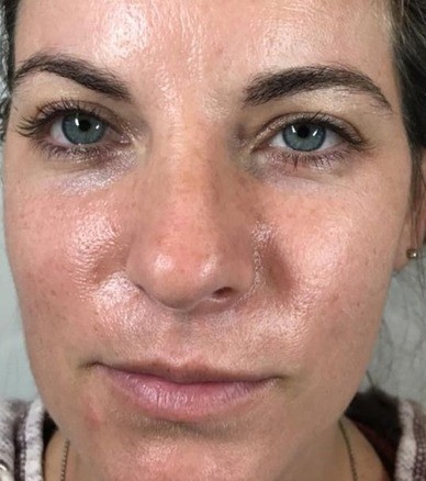 MOXI Laser1