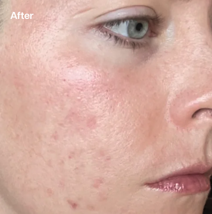 Premium & Signature Facials-2